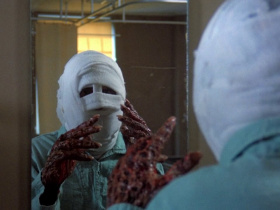 The Incredible Melting Man